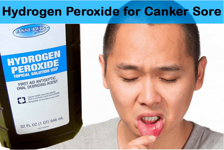 hydrogen peroxide for cranker sore with a man showing his lip