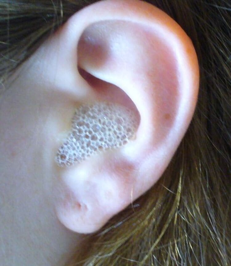 hydrogen peroxide ear cleaner