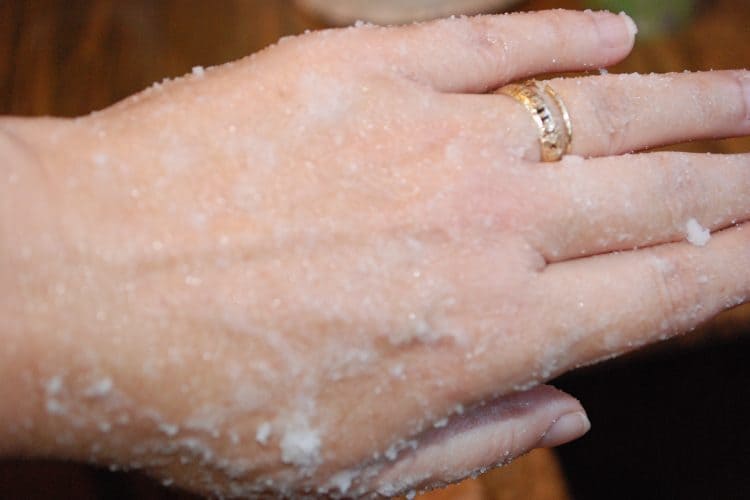 Back of hand lathered in petroleum jelly and baking soda paste for chapped and dry hand remedy